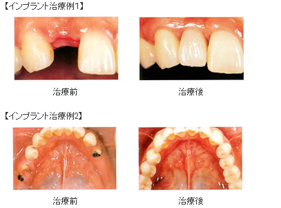 治療例